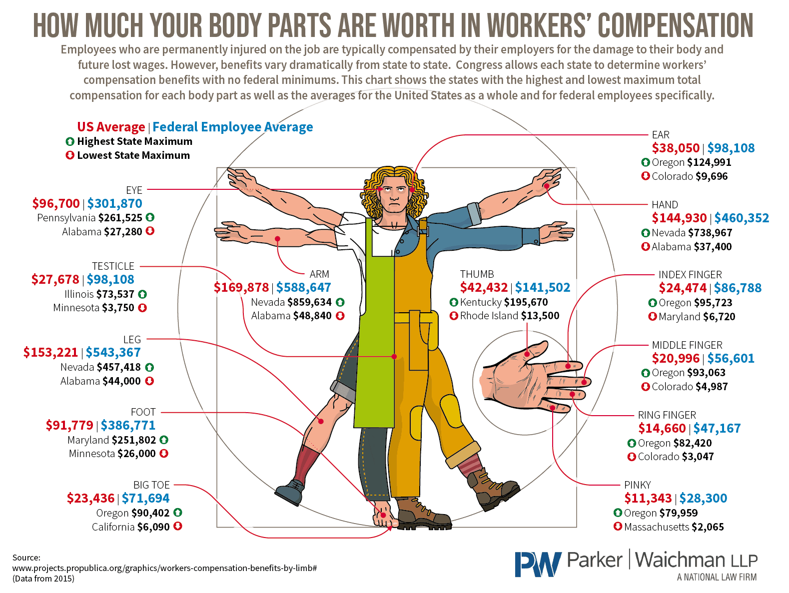 How Much Your Body Parts Are Worth in Workers’ Compensation Parker